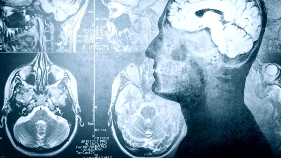 O moleculă anti-îmbătrânire ar putea ajuta la restabilirea memoriei în boala Alzheimer