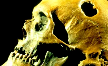 TREPANAŢIA, procedura extrem de periculoasă practicată încă de acum câteva mii de ani. Motivele pentru care strămoşii noştri îşi realizau orificii în cranii – FOTO